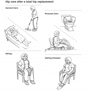Hip Care After a Total Hip Replacement