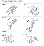 Caring for Your Chest Tube
