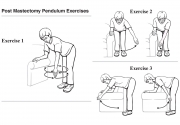 Post Mastectomy Exercises
