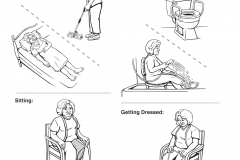 Hip Care After a Total Hip Replacement