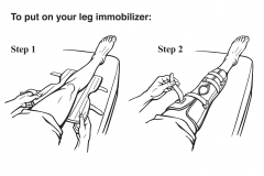 To Put On Your Leg Immobilizer