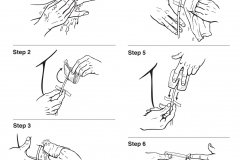 Caring for Your Chest Tube