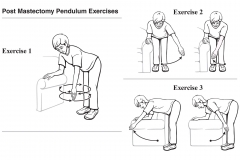 Post Mastectomy Exercises